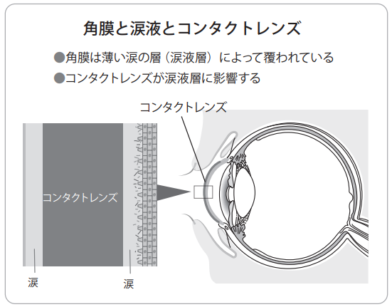 external_image external_image