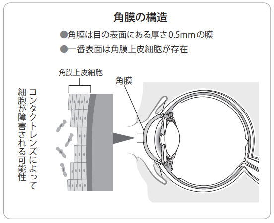 external_image external_image