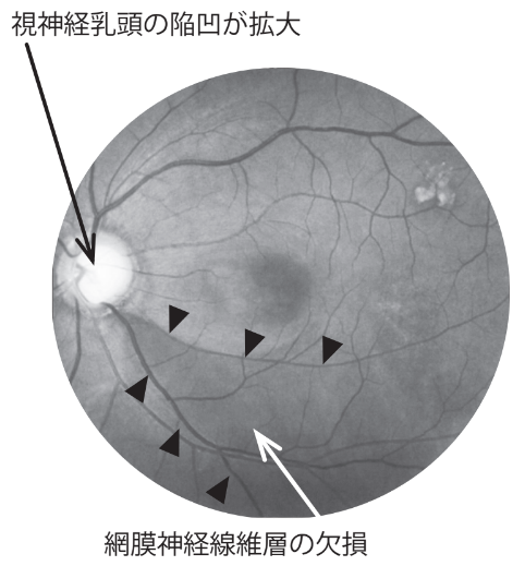 external_image external_image