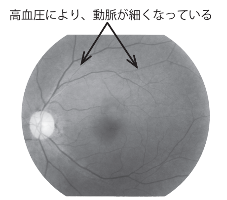 external_image external_image