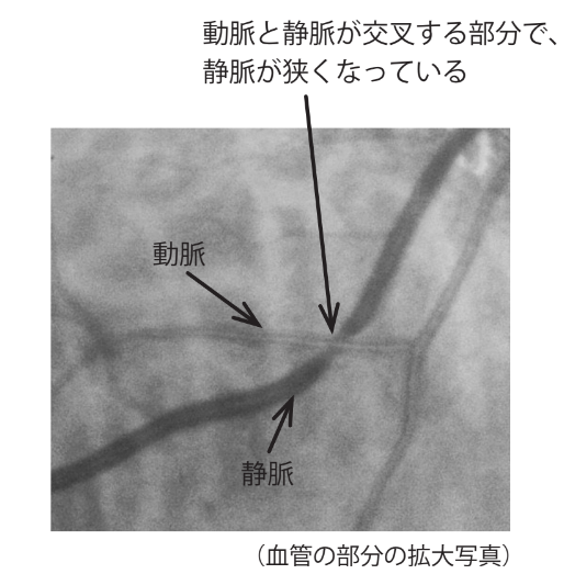 external_image external_image