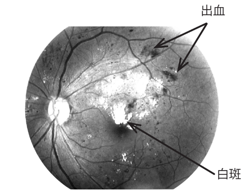 external_image external_image