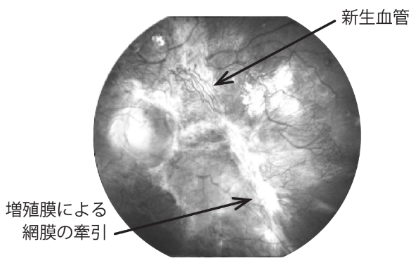 external_image external_image