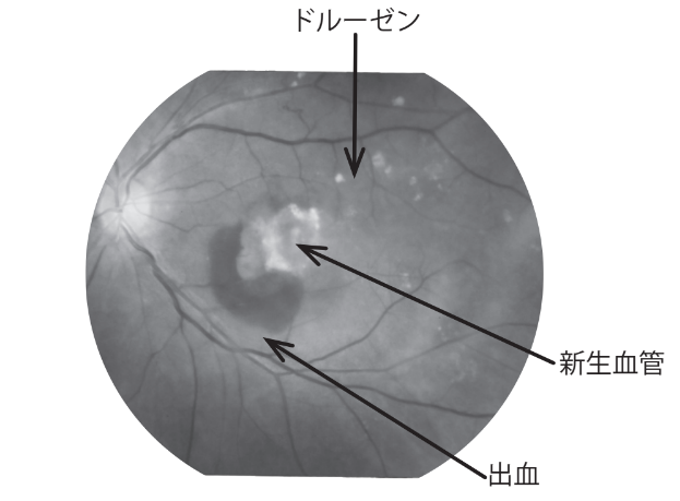 external_image external_image