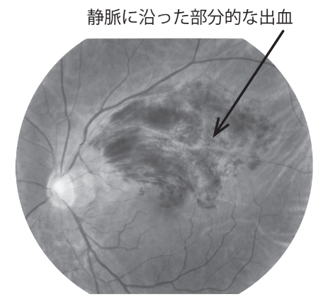 external_image external_image