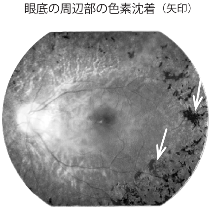 external_image external_image